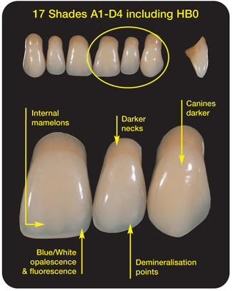 Enigma Cosmetic Dentures