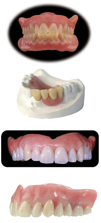 Enigma Cosmetic Dentures